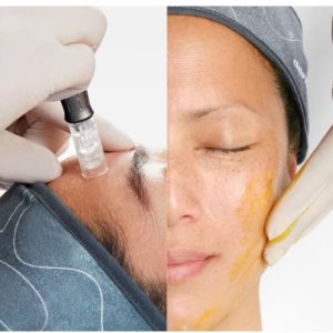 Pro Retinol