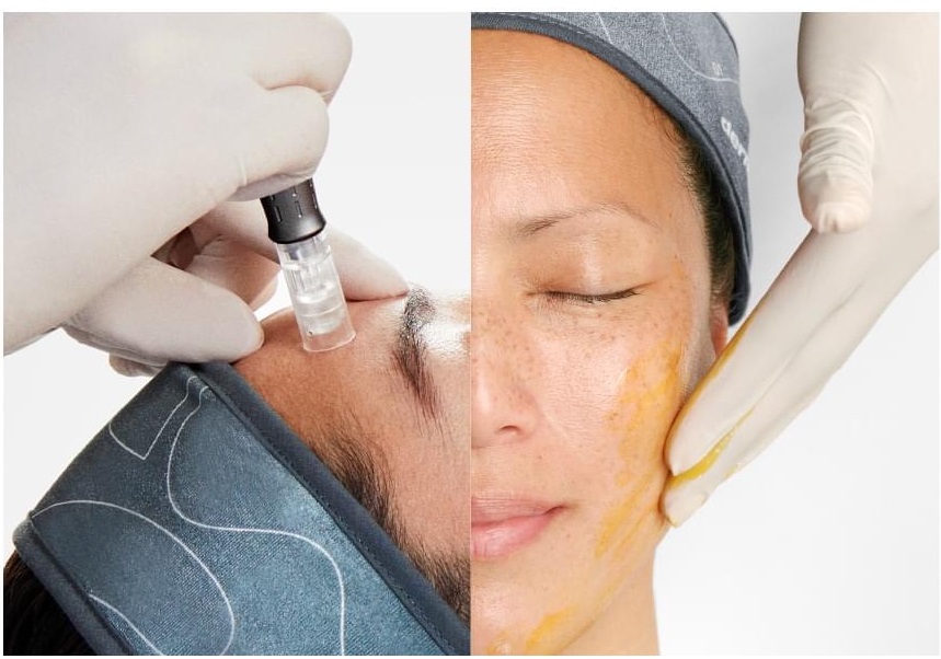 Pro Retinol